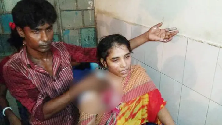 কলেজছাত্রীর শরীরে আগুন: ১৩ দিন পর না ফেরার দেশে ফুলন