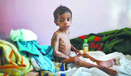 বিশ্বে দুর্ভিক্ষের মুখে ১০ কোটিরও বেশি মানুষ