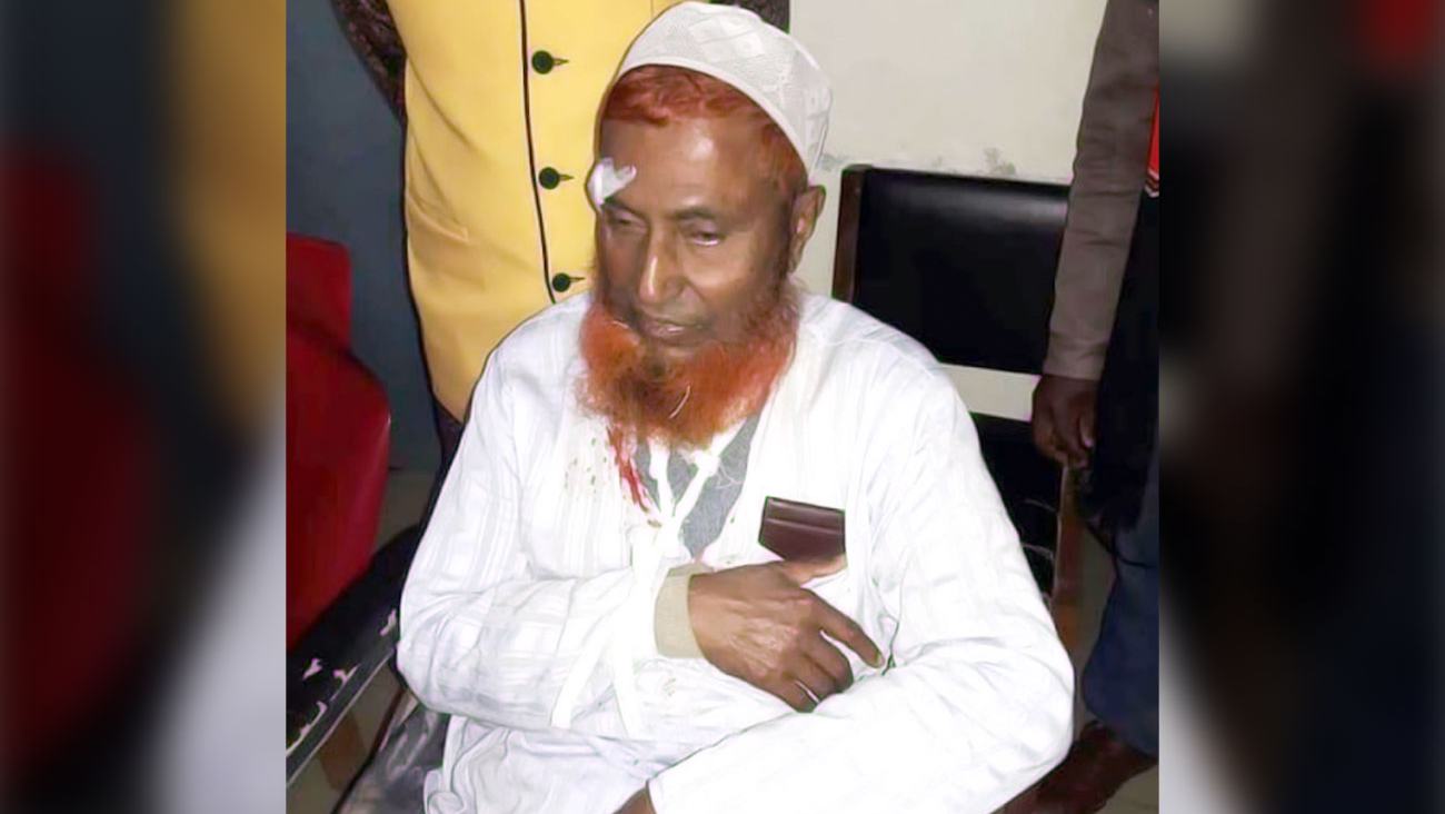মটরসাইকেল দুর্ঘটনায় আহত সাবেক উপজেলা চেয়ারম্যান জনাব মাওলানা তায়েব আলী...
