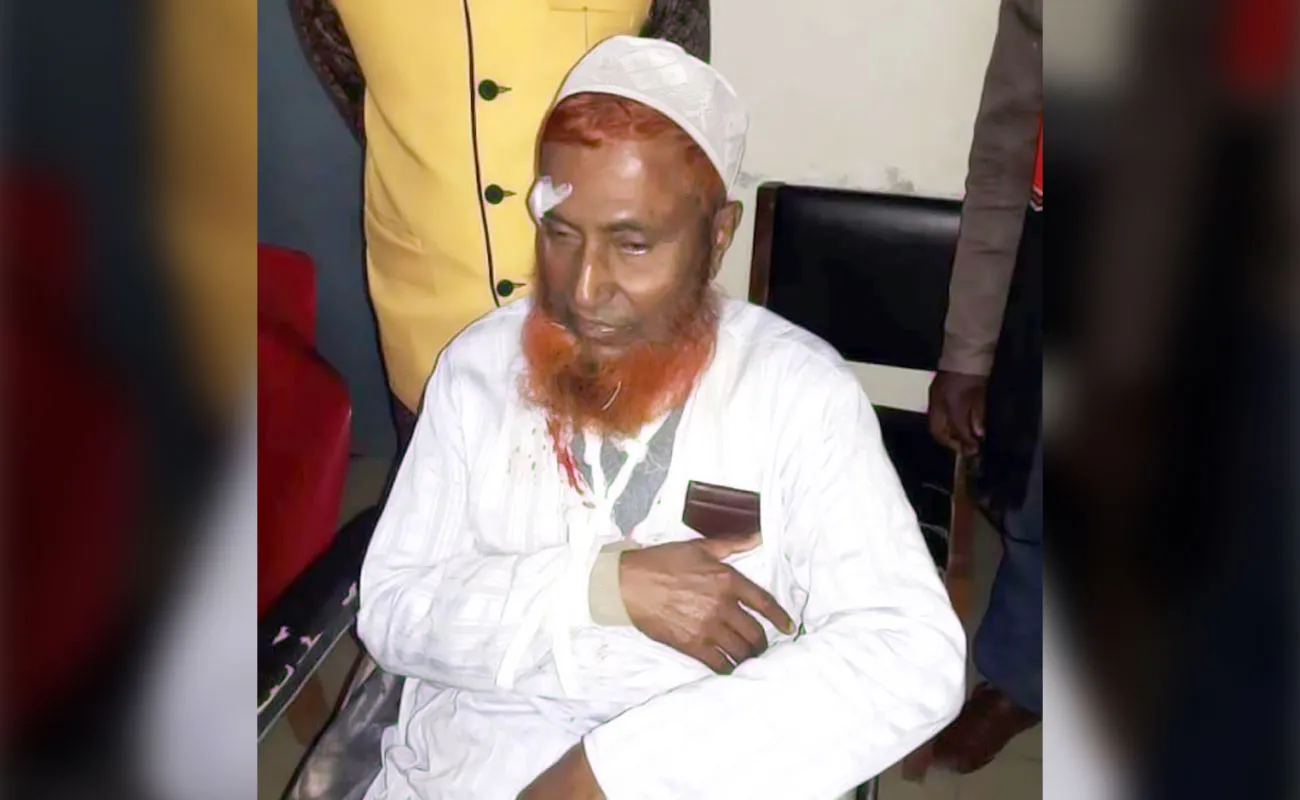 মটরসাইকেল দুর্ঘটনায় আহত সাবেক উপজেলা চেয়ারম্যান জনাব মাওলানা তায়েব আলী...