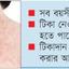 হঠাৎ হাম বেড়েছে, শিশু মারা যাচ্ছে