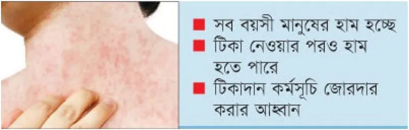 হঠাৎ হাম বেড়েছে, শিশু মারা যাচ্ছে
