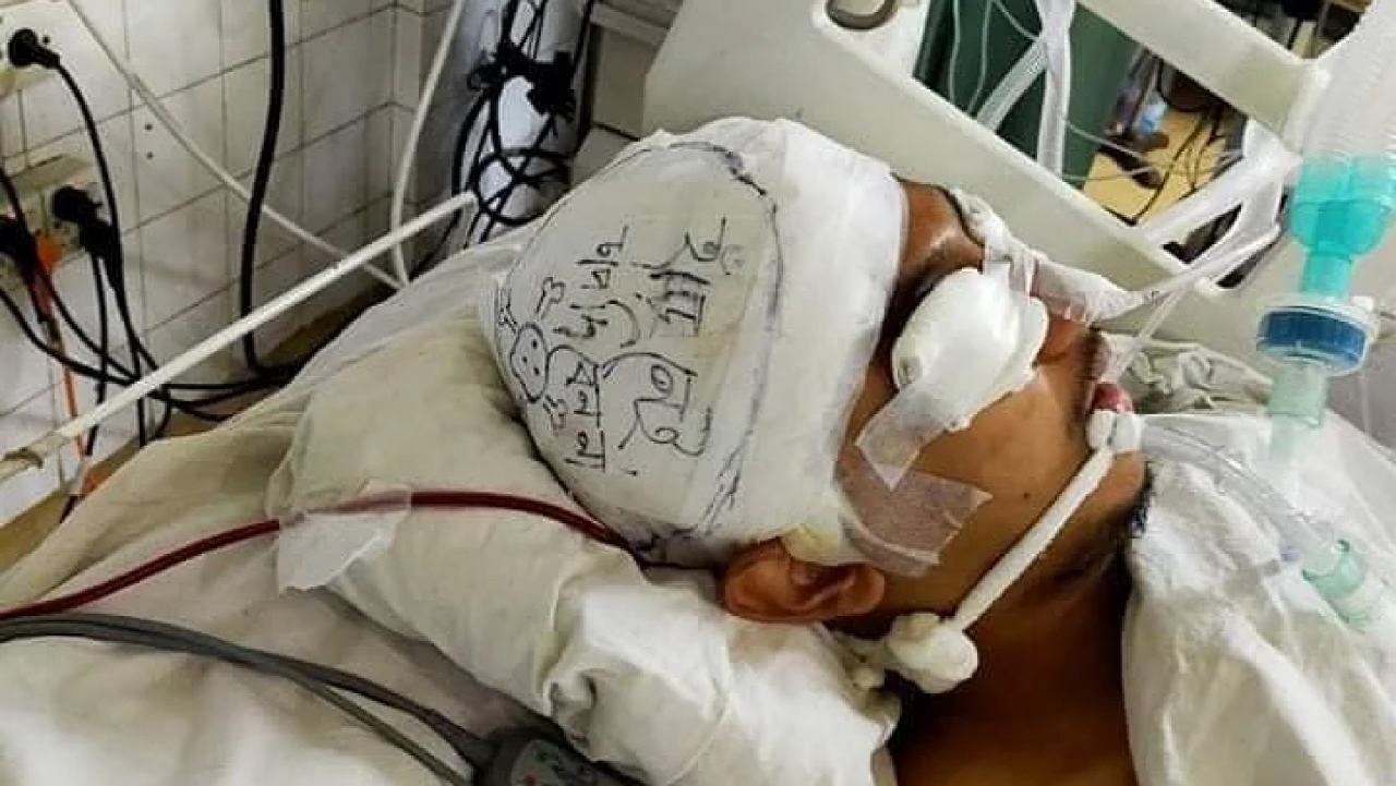 ঘটনা মর্মান্তিক....'হাড় নেই, চাপ দেবেন না' (প্রথম আলো অনলাইন)
