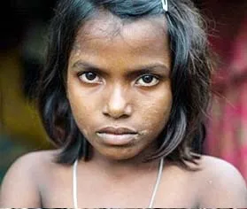বিশ্ববাসীর প্রতি এক রোহিঙ্গা ‘নূর কাজলের’ আহ্বান