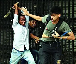 ভালো নেই আহত সাংবাদিকরা