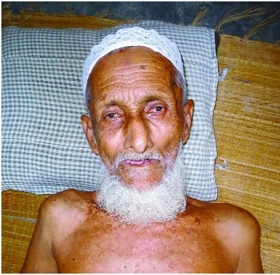 ৮৬ বছরের প্যারালাইসিস রোগী নাশকতা মামলার আসামি!